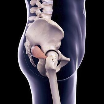 Dagger back pain could be due to piriformis muscle spasm