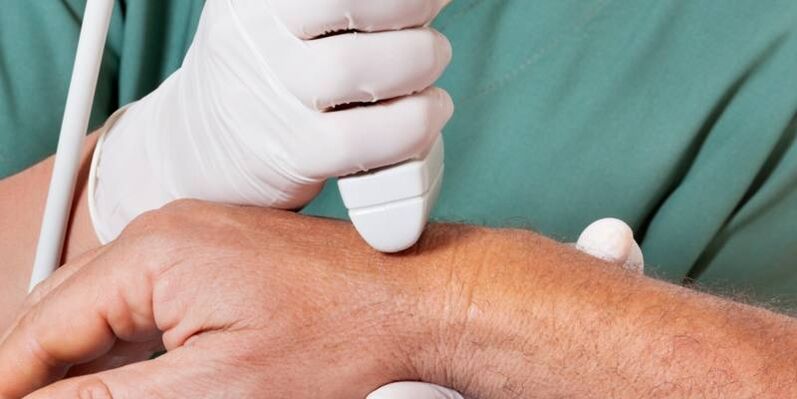 Arthritis as causes of pain in the joints of the fingers